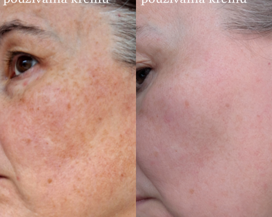 Modrá púpava | Rozjasnene pleti - Kozmetický balíček (3 produkty)